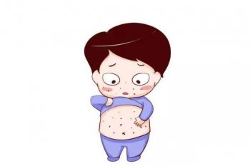 患了体癣怎么办